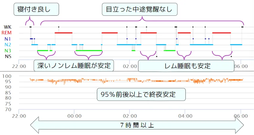 睡眠グラフを読む 〜脳波計測なら睡眠の質がここまで分かる！ ～ ｜S