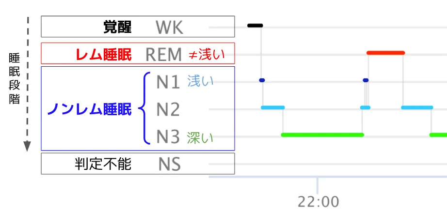 睡眠グラフを読む 〜脳波計測なら睡眠の質がここまで分かる！ ～ ｜S