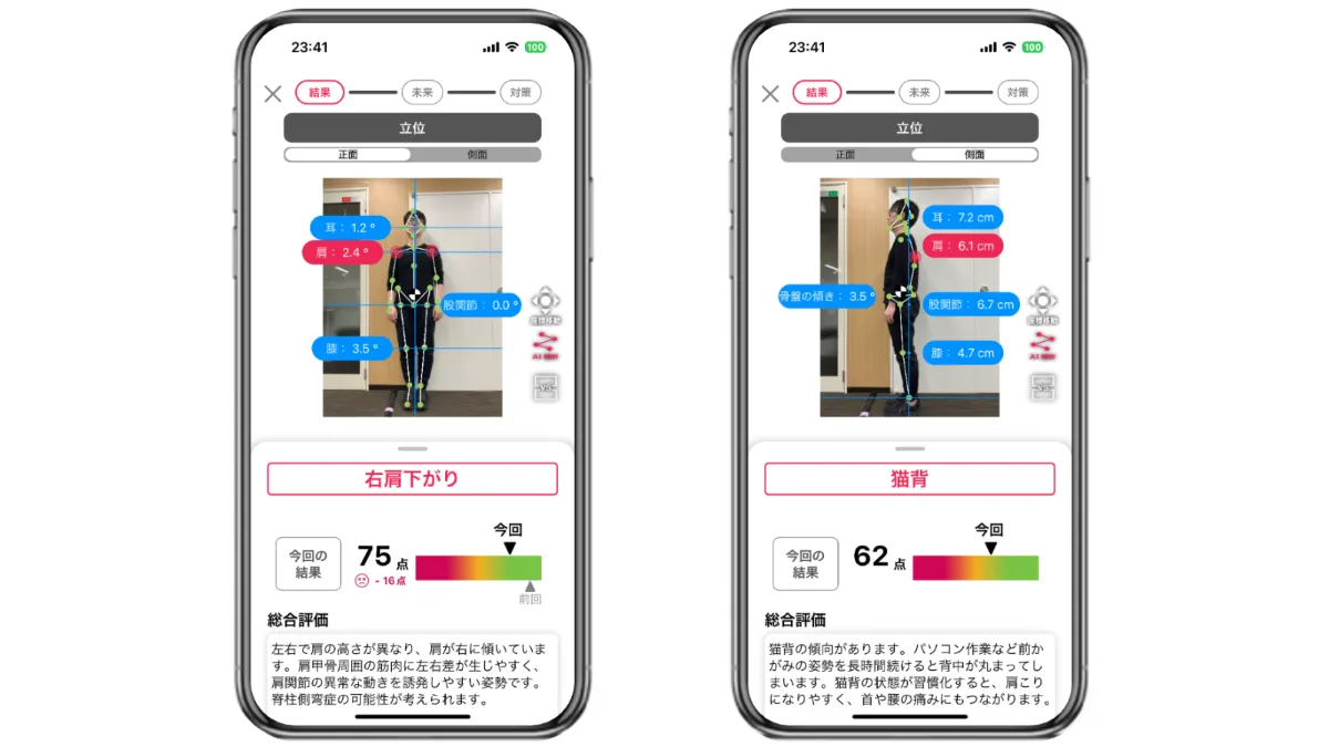 姿勢改善の重要性 | 株式会社Sportip