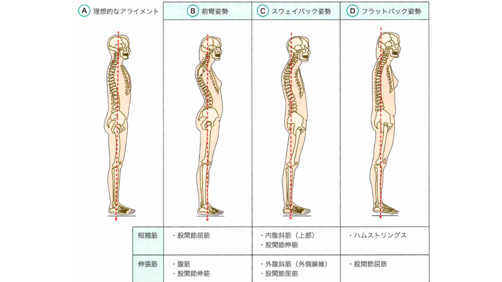 非特異的腰痛の評価と運動療法| 株式会社Sportip