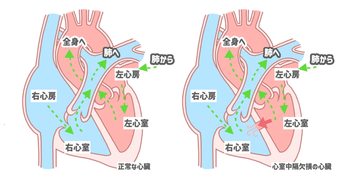 うさぎが食べない？実は心臓病かも（心室中隔欠損） | SAMCの症例紹介