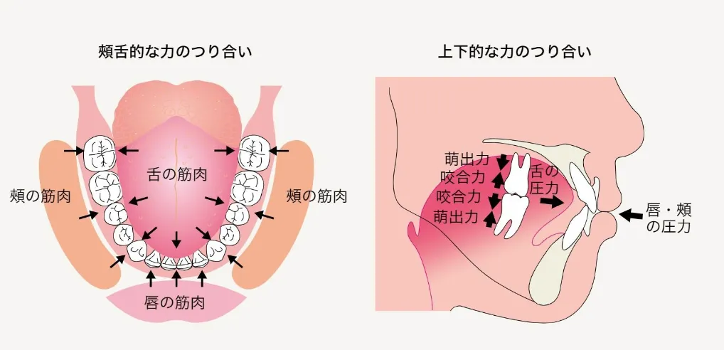 口腔筋機能療法(MFT)の臨床