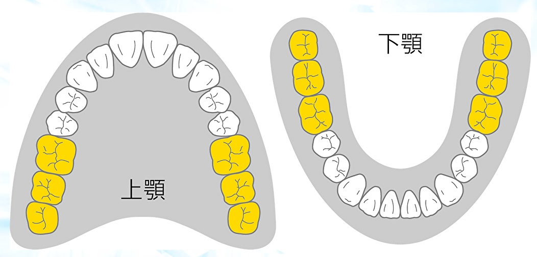 PEEK冠の基本 ｜エミウム クラウド技工