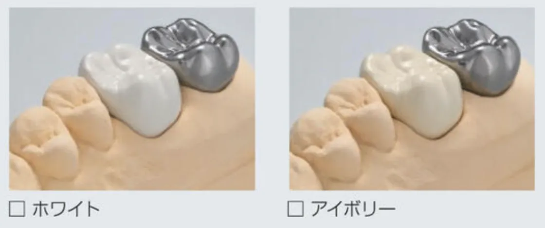 医療材料専門書 - PEEK 歯科・外科　医療材料 大臼歯(奥歯)の白い歯「PEEK」が新保険適応となりました！令和5年12月1