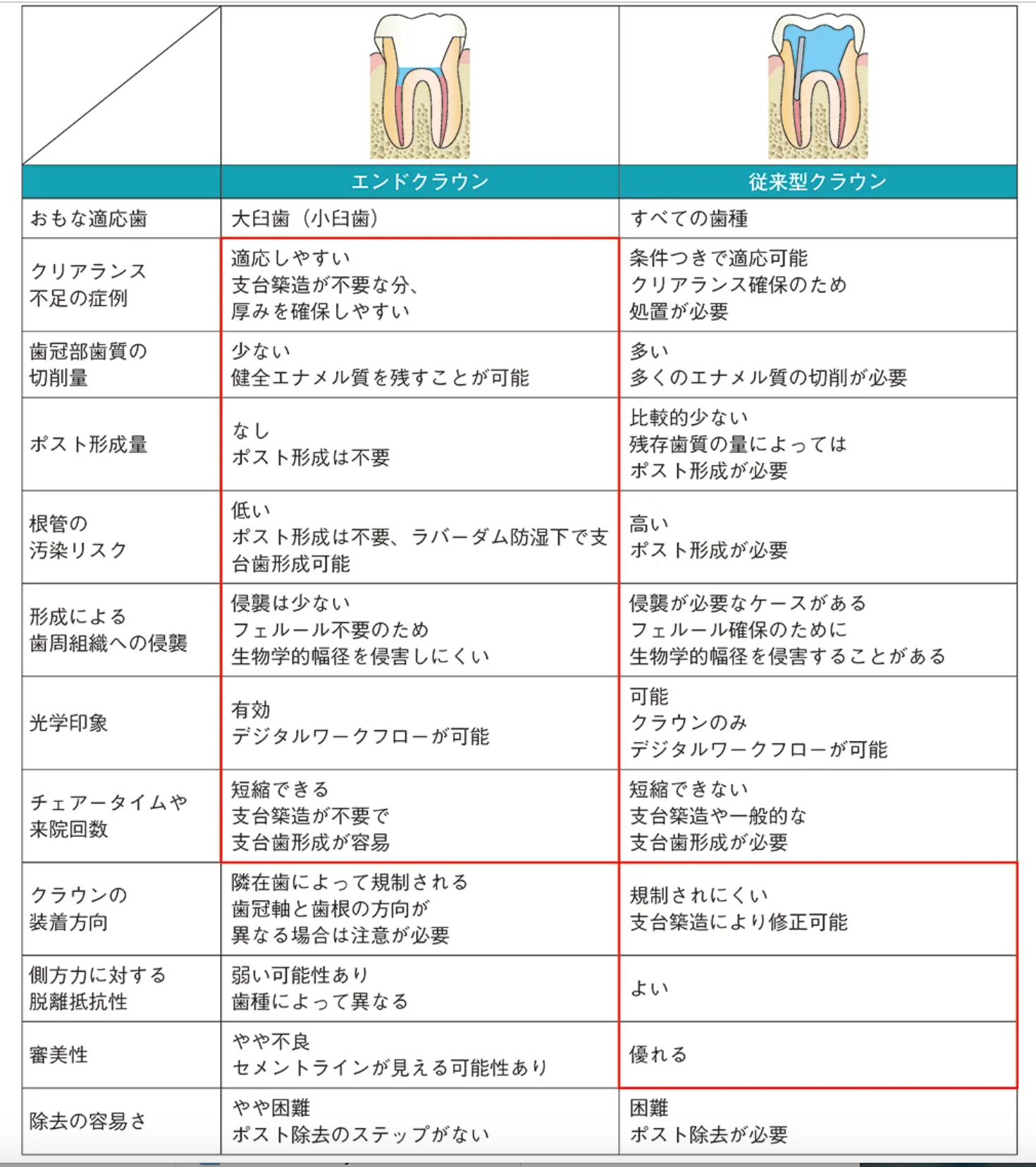エンドクラウンの基本 ｜エミウム クラウド技工