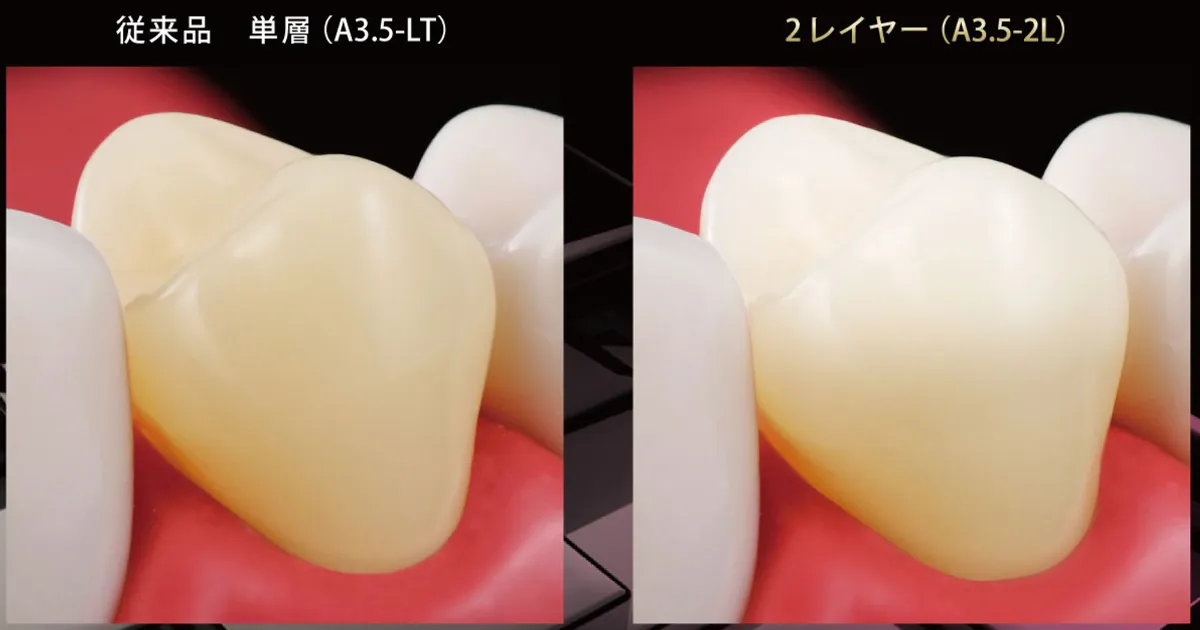 CAD/CAM冠ブロックの特徴比較 |エミウム クラウド技工 CAD/CAM冠ブロックの特徴比較 |エミウム クラウド技工