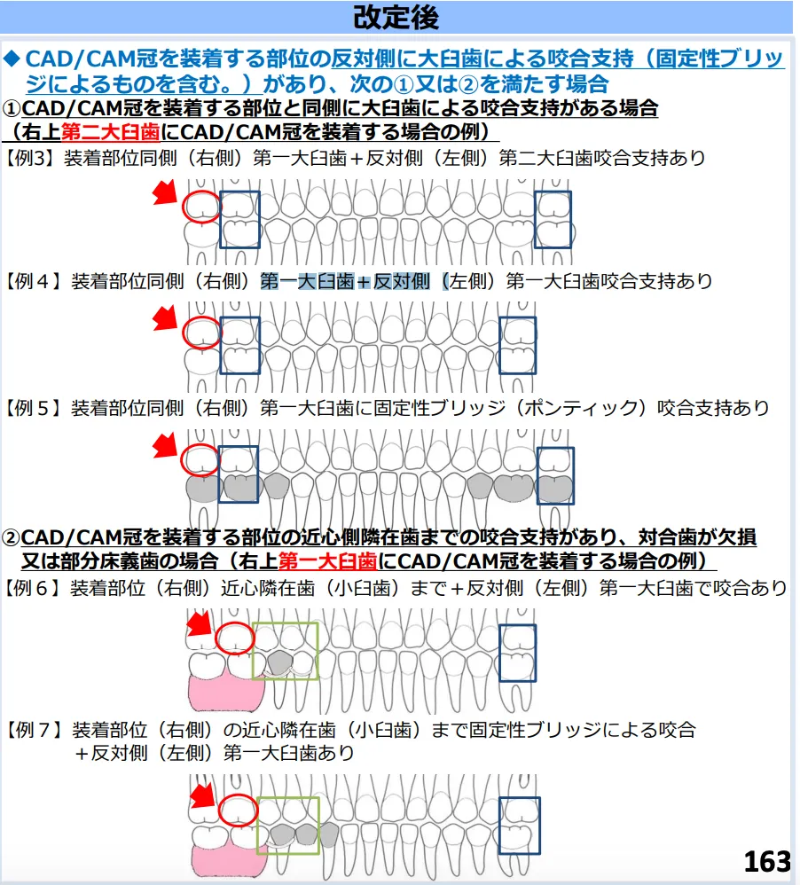 2024年 歯科の診療報酬改定のポイント ｜エミウム クラウド技工