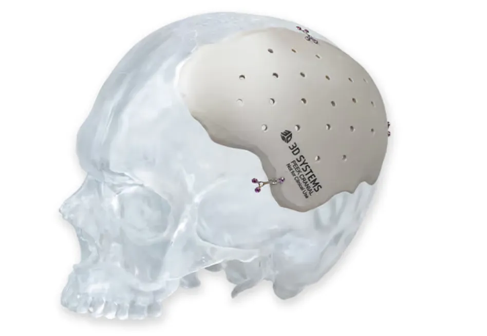 PEEK冠の基本 ｜エミウム クラウド技工