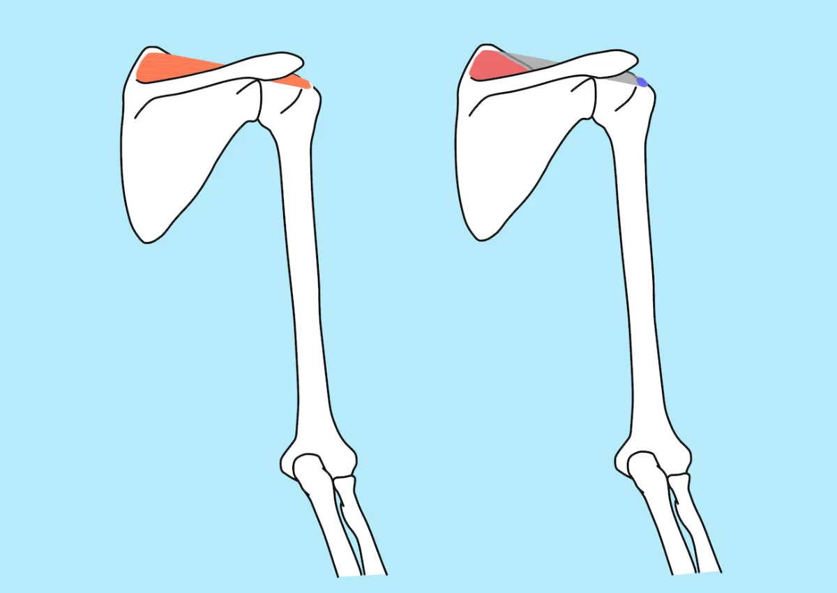 棘上筋（きょくじょうきん） の起始と停止・作用と神経支配