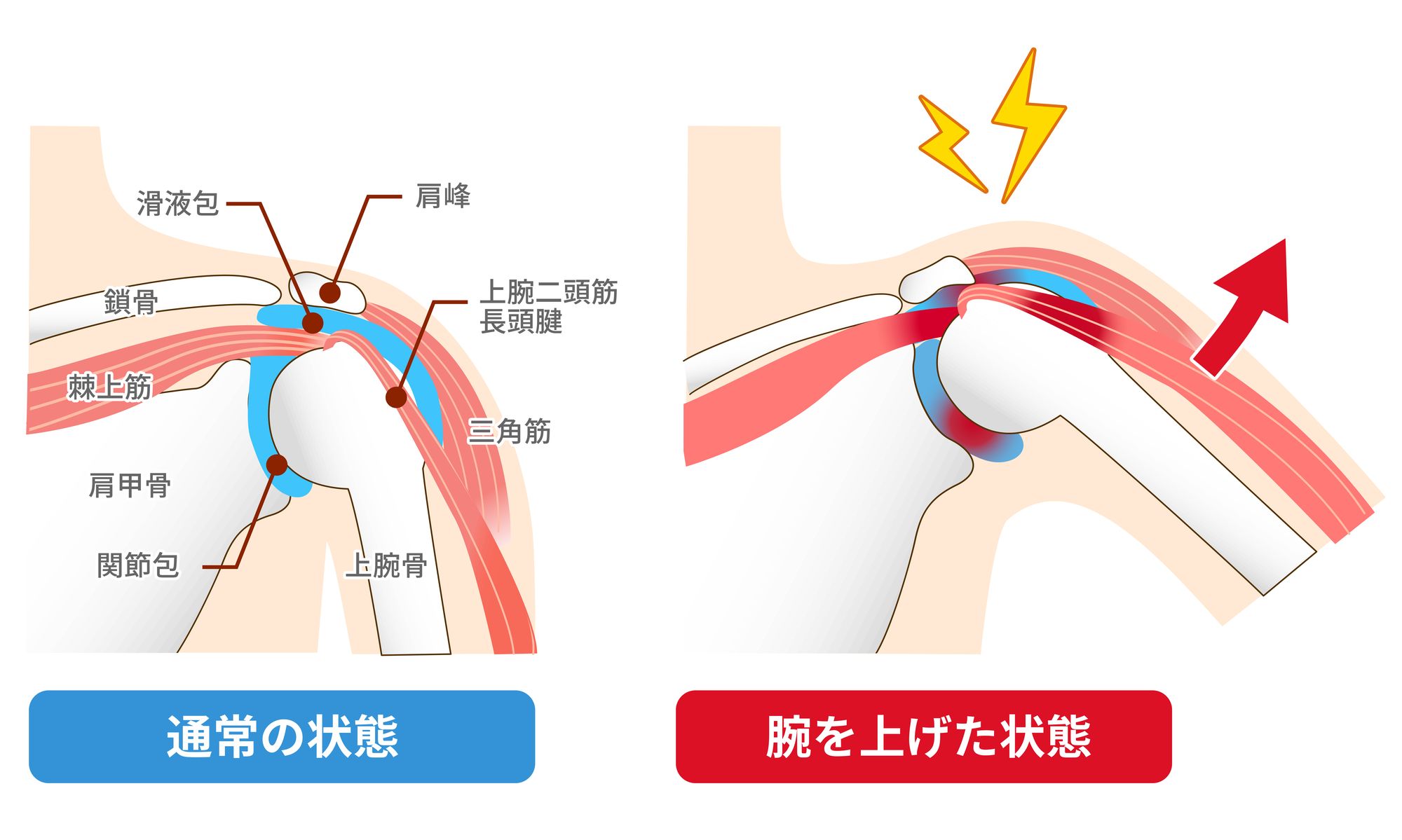 肩関節の極意. 痛み編 肩関節の極意 痛み編 - 運動と医学の出版社