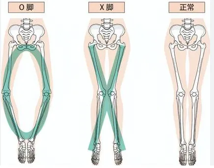 コラム｜シンセルクリニック - ひざ・肩・股関節に特化した再生