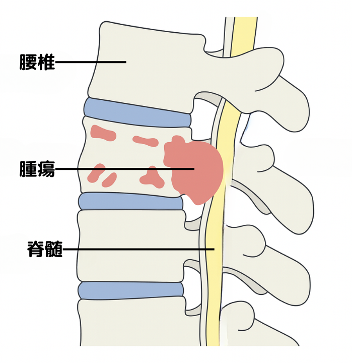 腰痛 神経痛 などに あなたの腰の痛みはどのタイプ？ 五輪スポーツドクターの「腰痛の治し