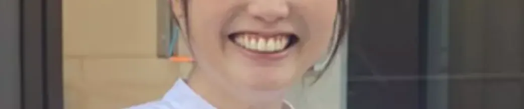 歯科矯正で美人になった人はどこが変わった 矯正中も笑顔美人を目指せる方法とは 自宅でマウスピース矯正 Oh My Teeth 歯科矯正で美人になった人はどこが変わった 矯正中も笑顔美人を目指せる方法とは 自宅でマウスピース矯正 Oh My Teeth