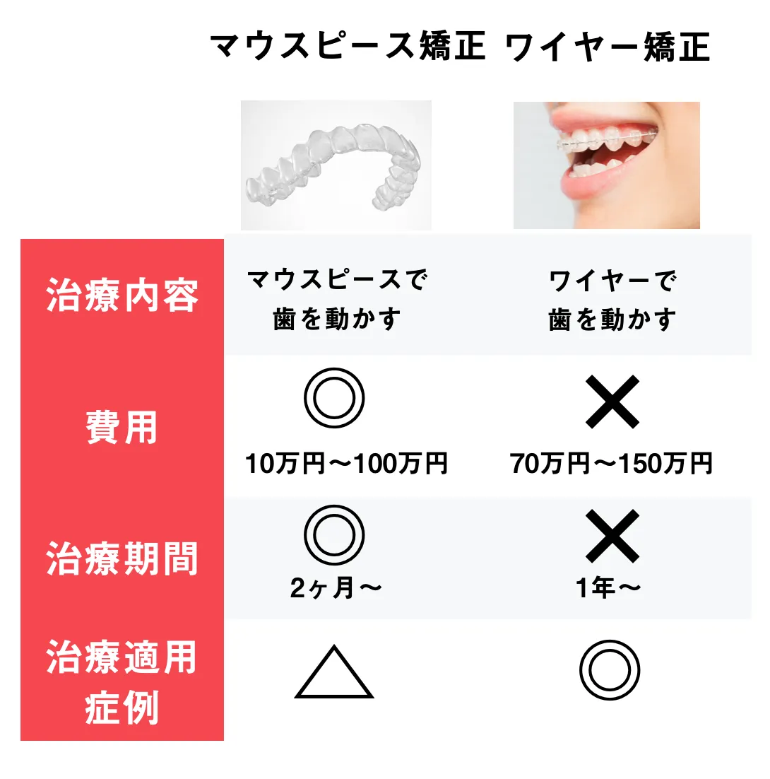 八重歯と犬歯との違いとは マウスピース矯正でなおせるも解説 自宅でマウスピース矯正 Oh My Teeth