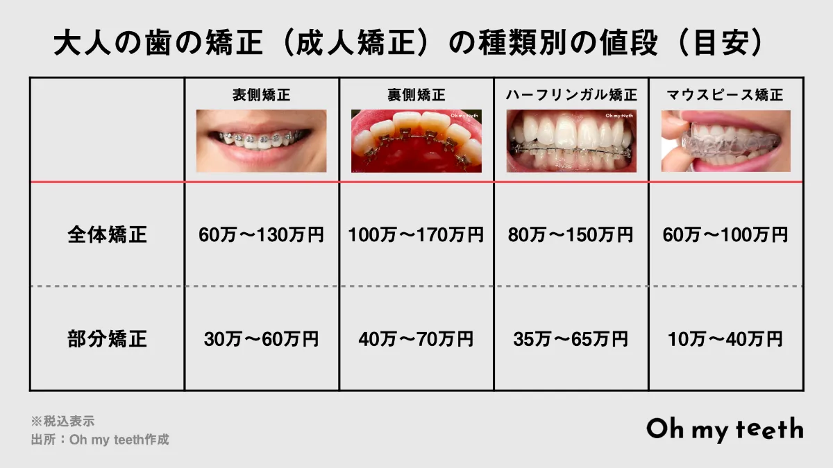 大人の歯の矯正の値段はいくら マウスピース ワイヤーなど種類別で費用を紹介 歯科矯正ブログ マウスピース矯正 Oh My Teeth