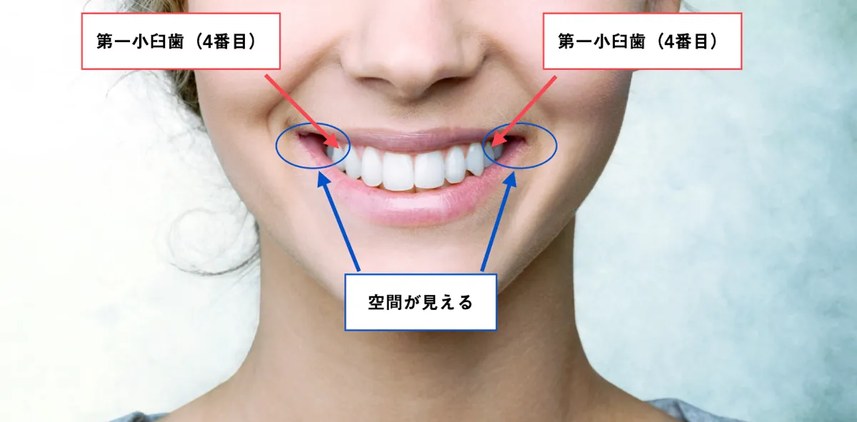 歯科矯正で起こる顔の変化とは 横顔やエラへの影響とその理由 自宅でマウスピース矯正 Oh My Teeth