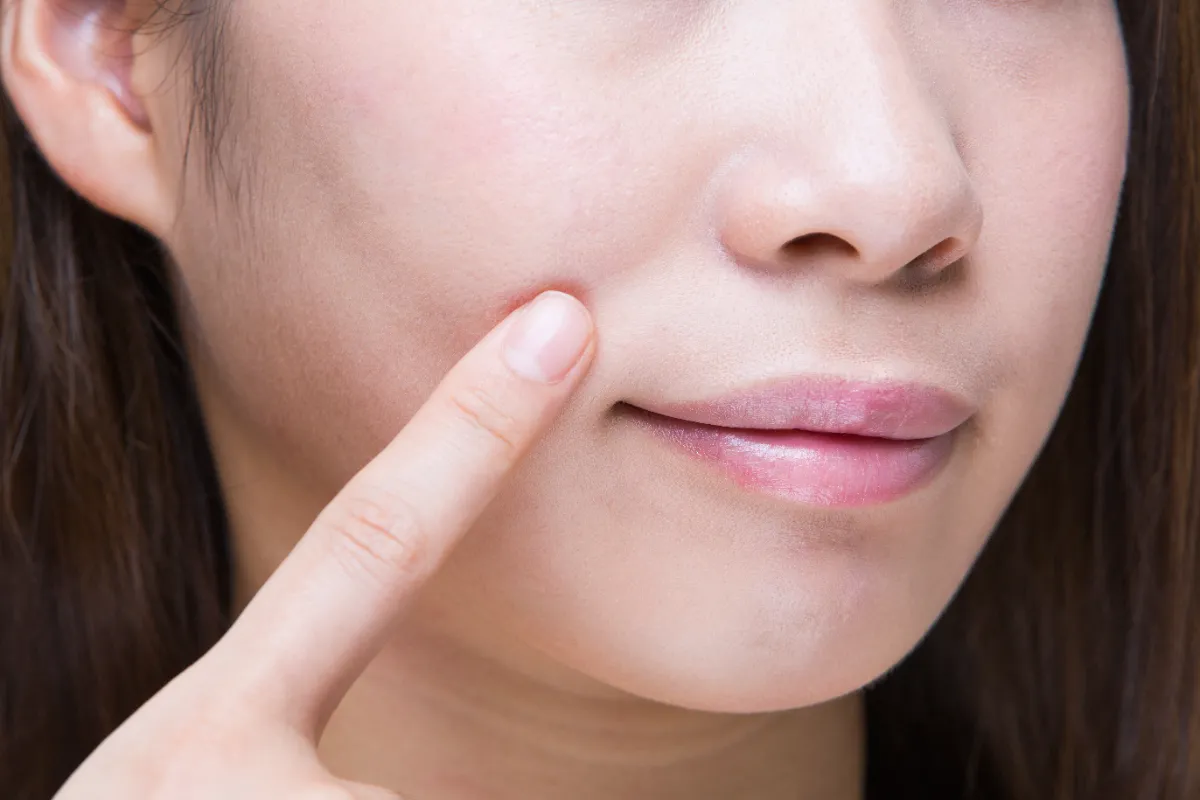 歯科矯正で老けた 原因と注意すべきポイントを徹底解説 自宅でマウスピース矯正 Oh My Teeth 歯科矯正で老けた 原因と注意すべきポイントを徹底解説 自宅でマウスピース矯正 Oh My Teeth