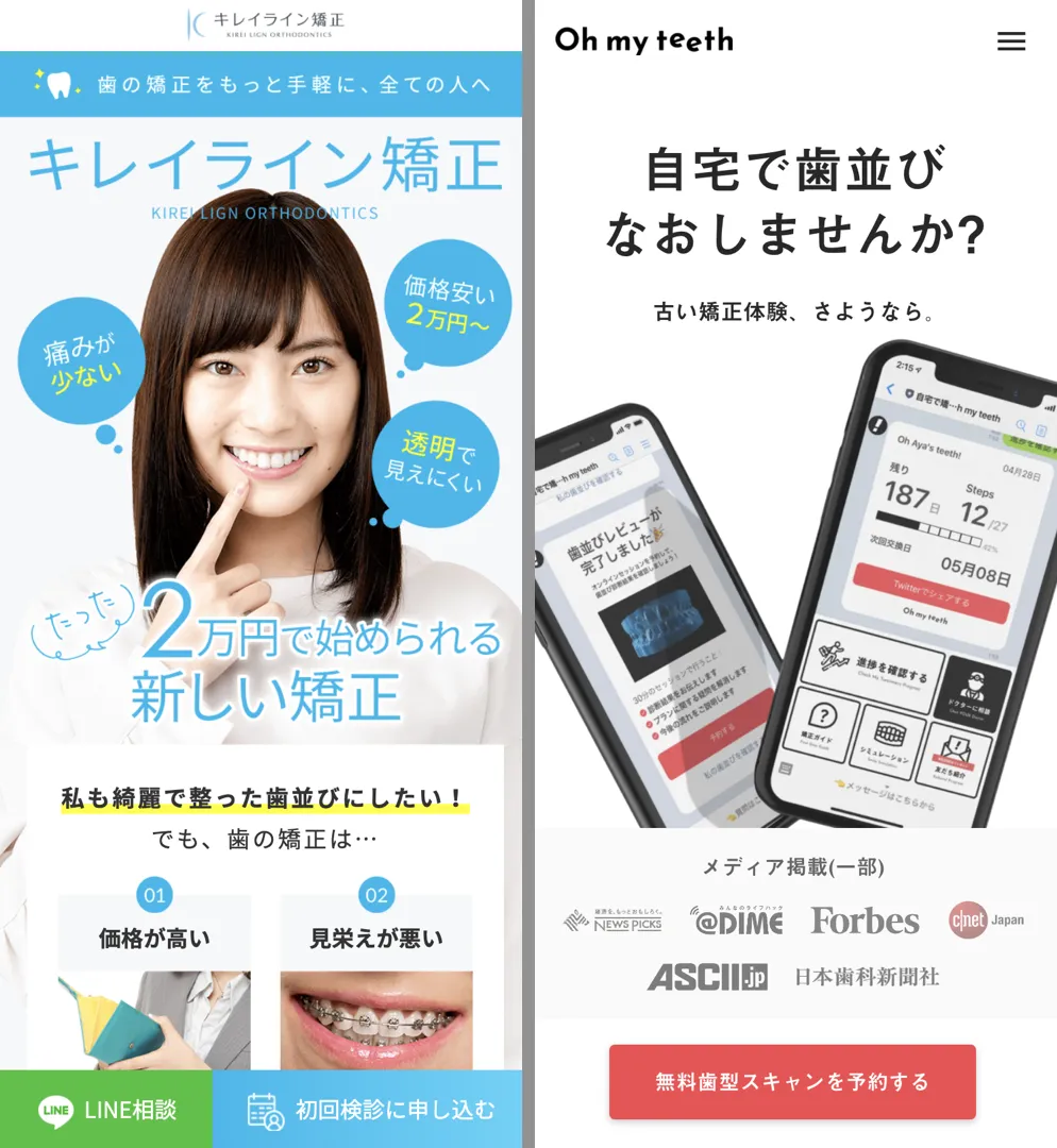 名古屋 キレイ ライン 矯正