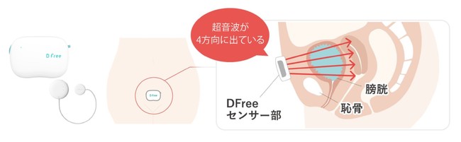 排泄予測デバイス『DFree』のクラウド自動連携を実現 排泄予測デバイス『DFree』のクラウド自動連携を実現