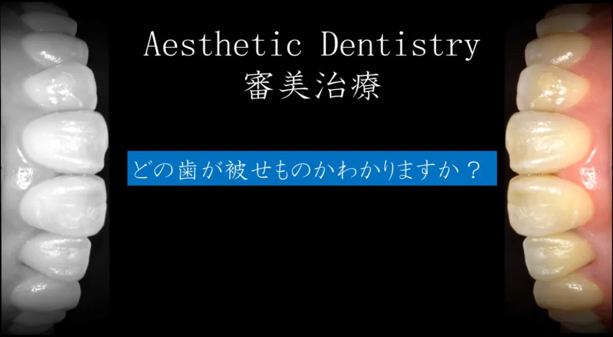 審美歯科(セレック)| 医療法人 歯科ハミール 審美歯科(セレック)| 医療法人 歯科ハミール