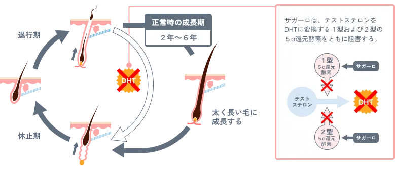 男性型脱毛症｜ようこ皮ふ科