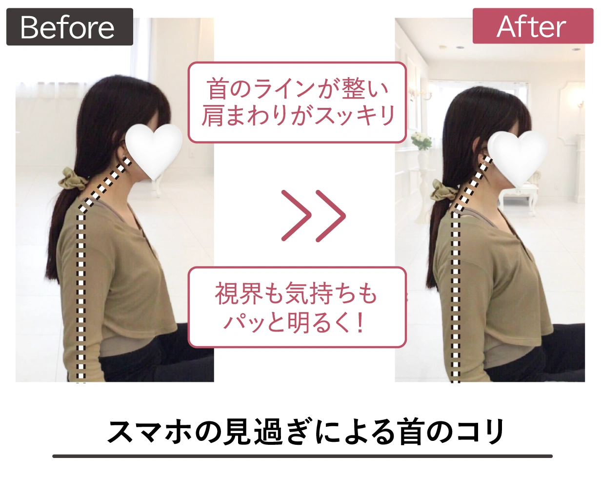 のビフォーアフター写真
