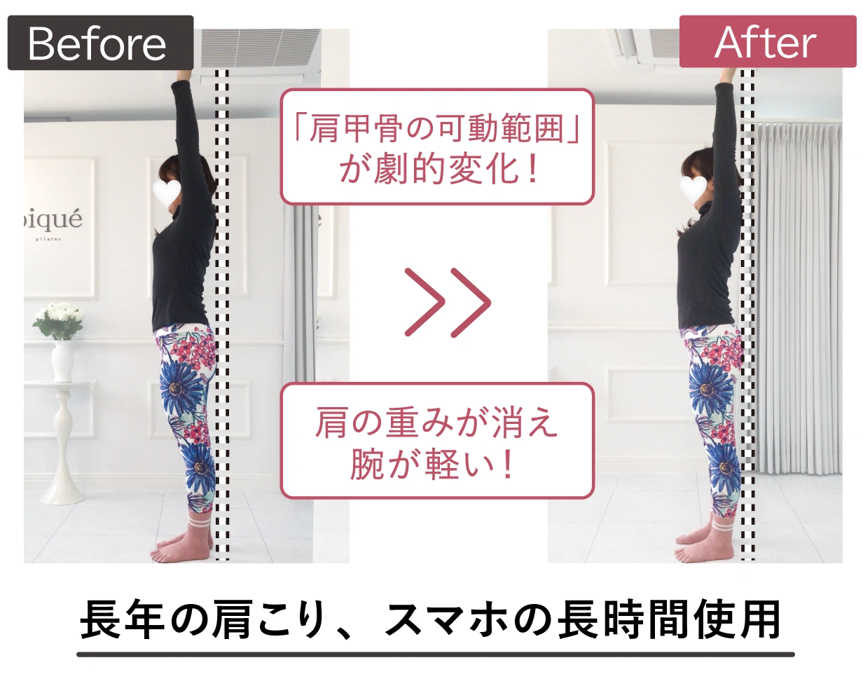 のビフォーアフター写真