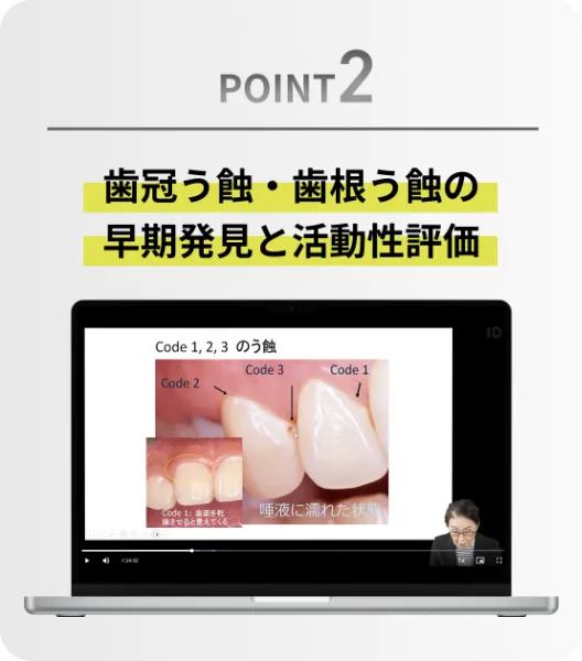 【裁断済み】歯を守るう蝕治療　非切削う蝕治療へのパラダイムシフト 新古品裁断済 歯を守る う蝕治療 非切削う蝕治療の