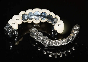 メタルボンド用の金属　歯科技工　12g メタルボンド | 東京の自費技工専門歯科技工所 | ケン・デンタリックス