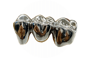 メタルボンド | 東京の自費技工専門歯科技工所 | ケン・デンタリックス