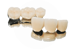 デンチャー | 東京の自費技工専門歯科技工所 | ケン・デンタリックス