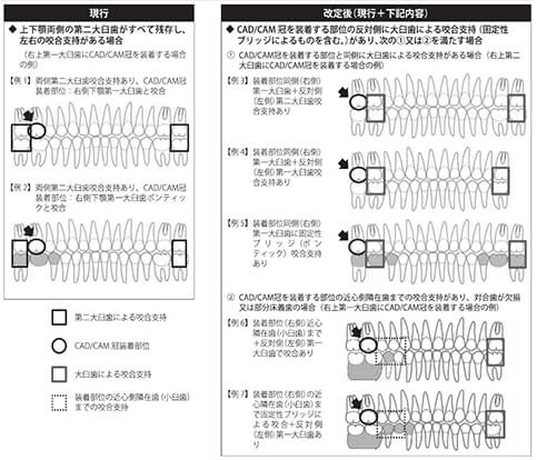 CAD/CAM冠 | 東京の自費技工専門歯科技工所 | ケン・デンタリックス