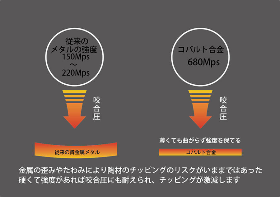 メタルボンド | 東京の自費技工専門歯科技工所 | ケン・デンタリックス