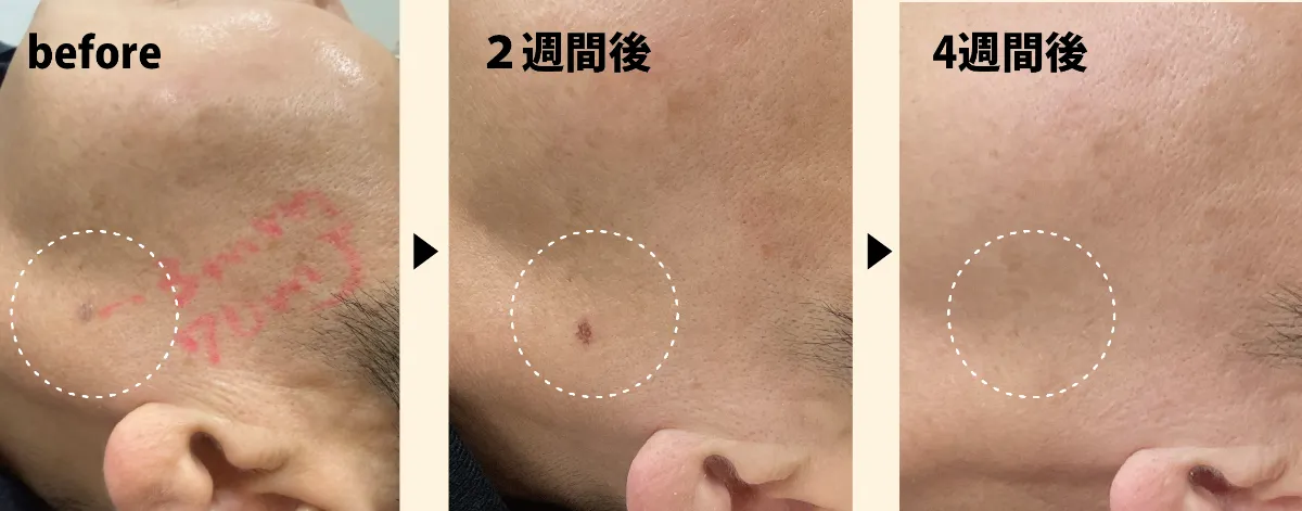 2025年11月のキャンペーンのご案内｜東京銀座の美容皮膚科｜トラスト