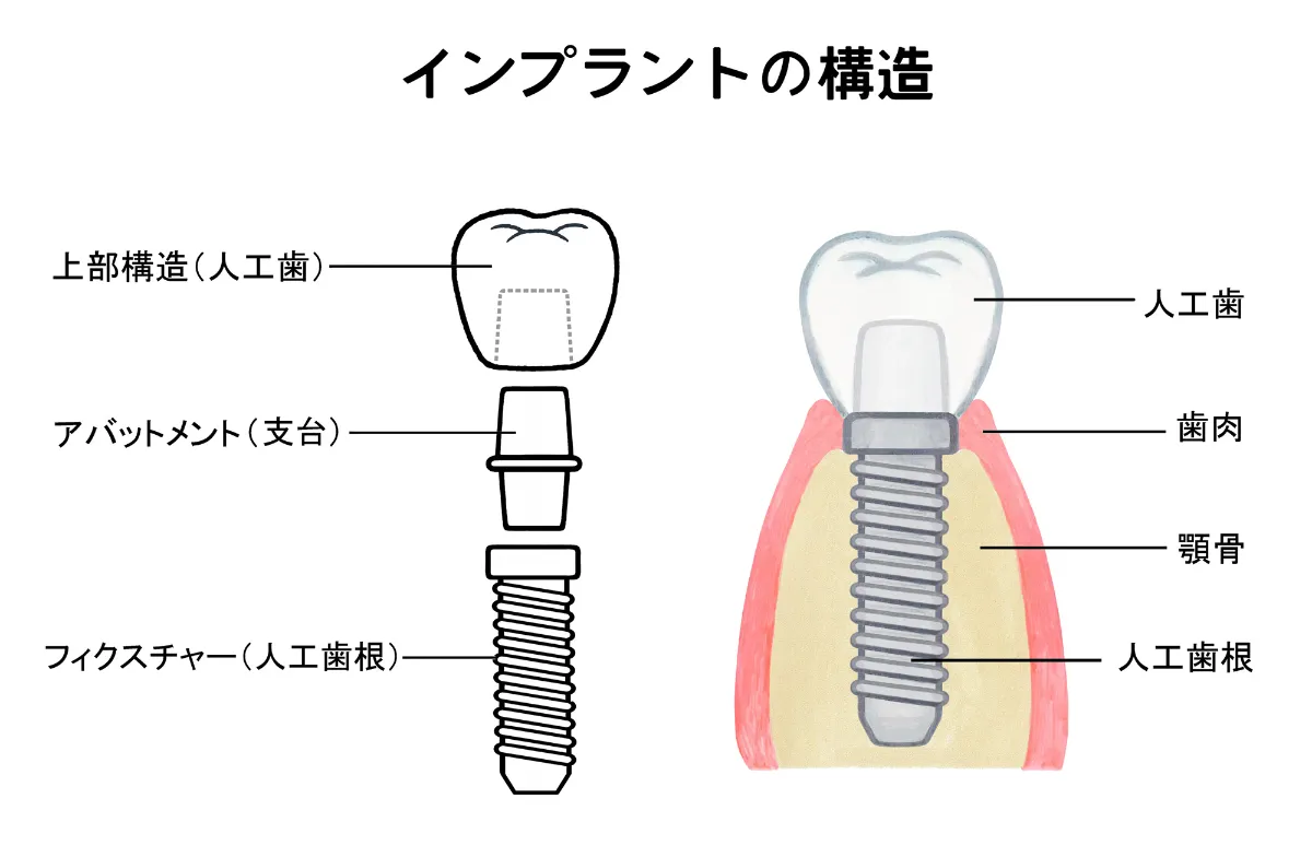 アナトミー2: もう一度確認したいインプラント臨床のための解剖