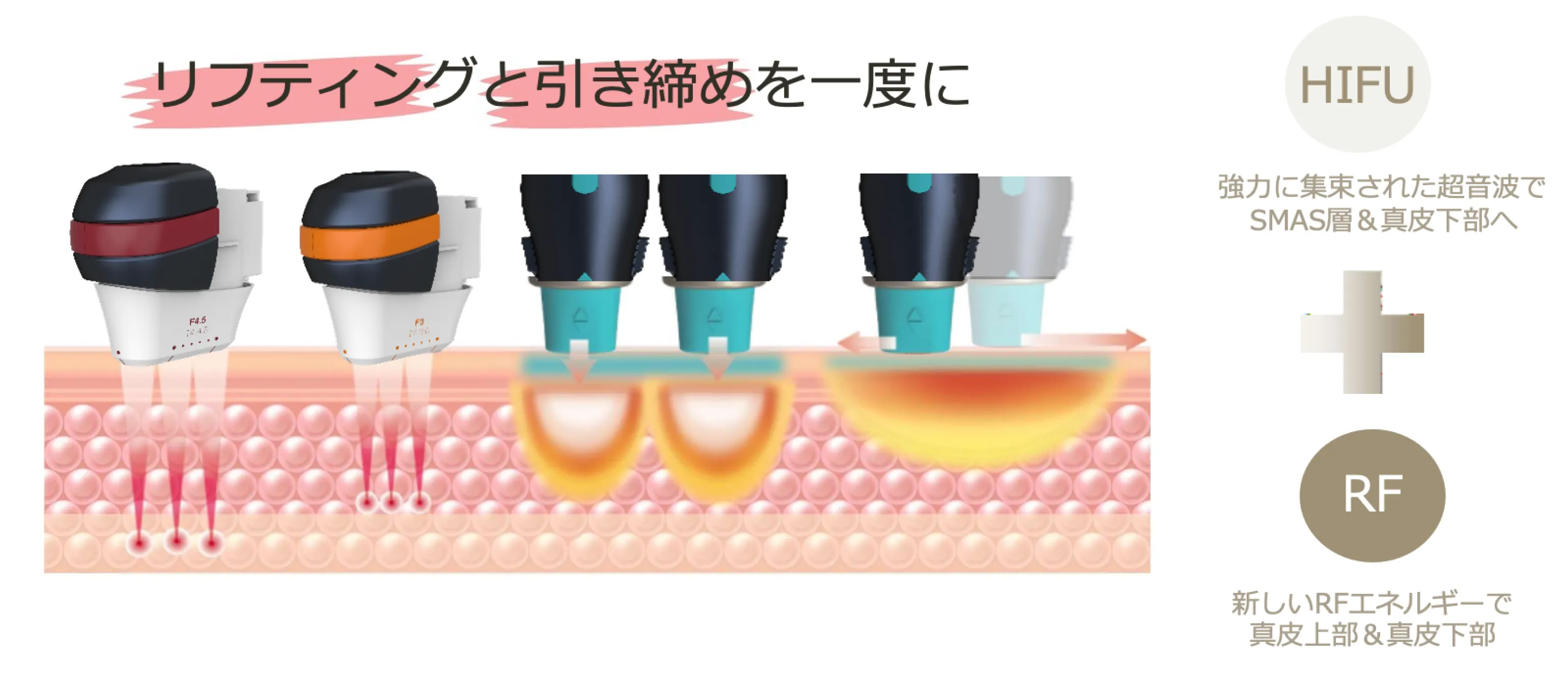 ‪ ·͜·hifuyu おまとめ‪ ·͜· オリジオKISS｜六本木の美容皮膚科 エバーグリーンメディカルクリニック