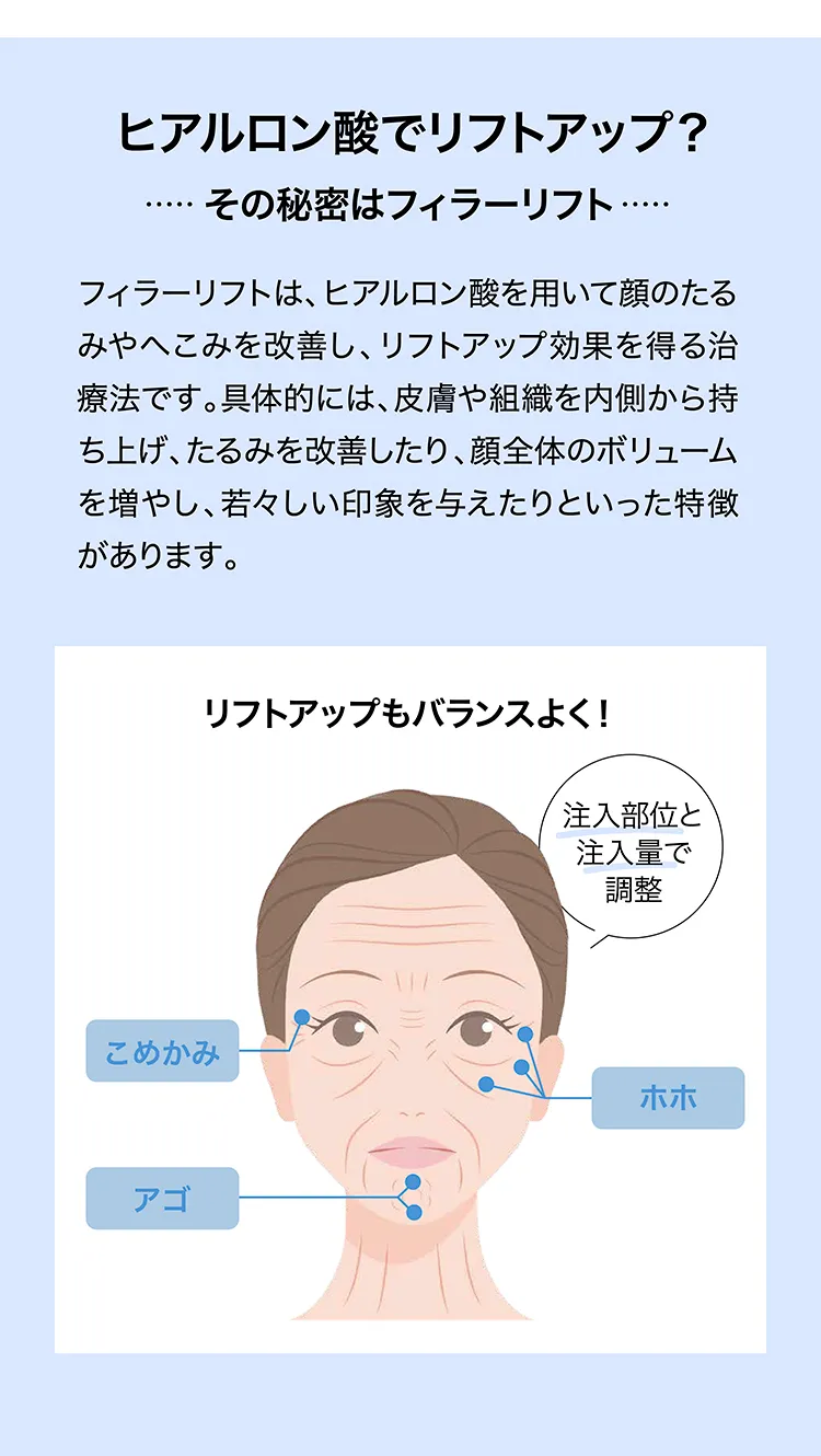 ヒアルロン酸 | 新宿三丁目メディカルクリニック