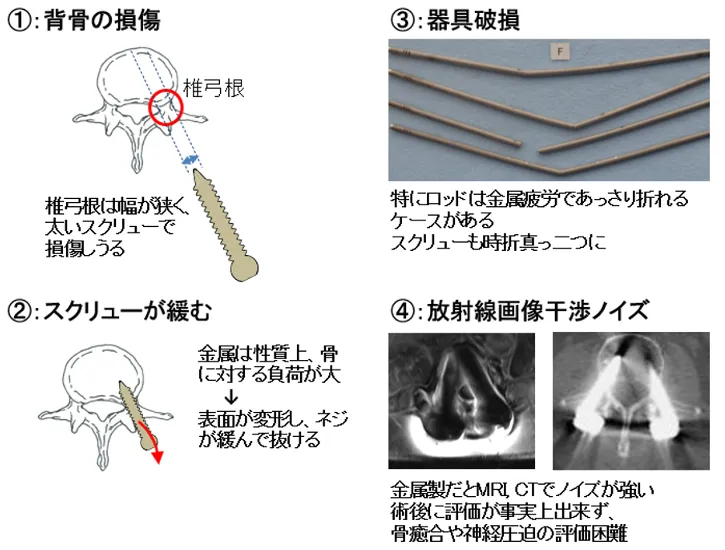 株式会社スパインテック（Spine-tech Inc.）