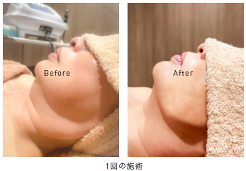 初回限定】【新登場】韓国・Instagramで話題のレモンボトルが登場