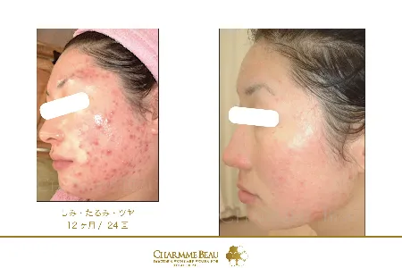 シャルム・ボー