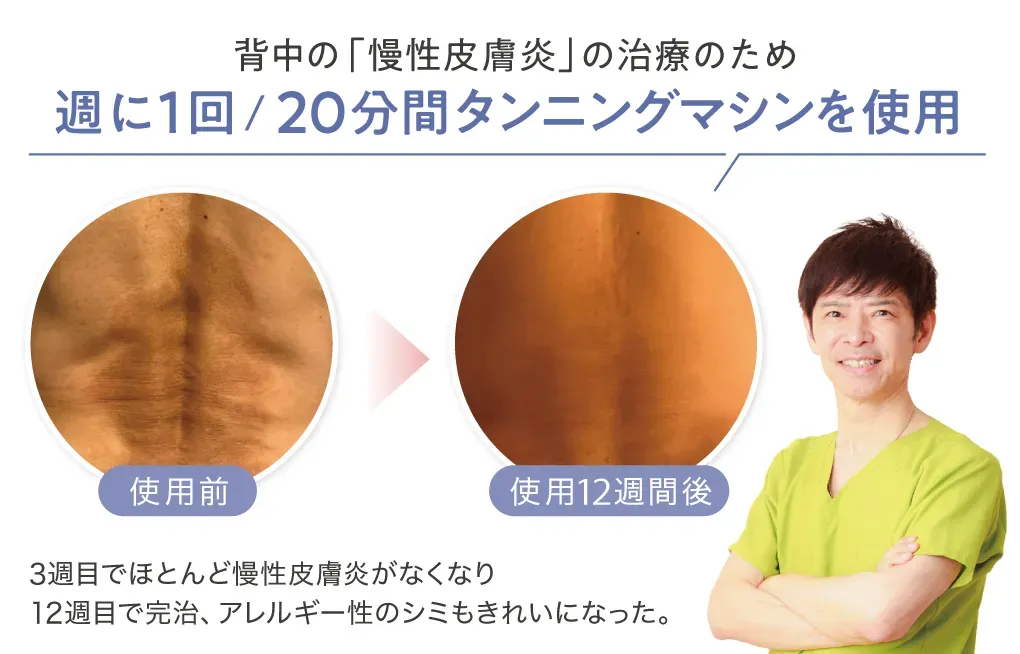 PHILIPS 日焼けマシン 自然光効果天然シェーディング ビタミンD生成 Dr.南雲に聞く！ビタミンDの話 | タンニング（日焼け）マシン