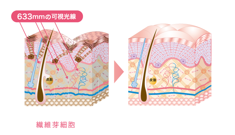 コラーゲンマシン　alisun コラーゲンマシン alisun