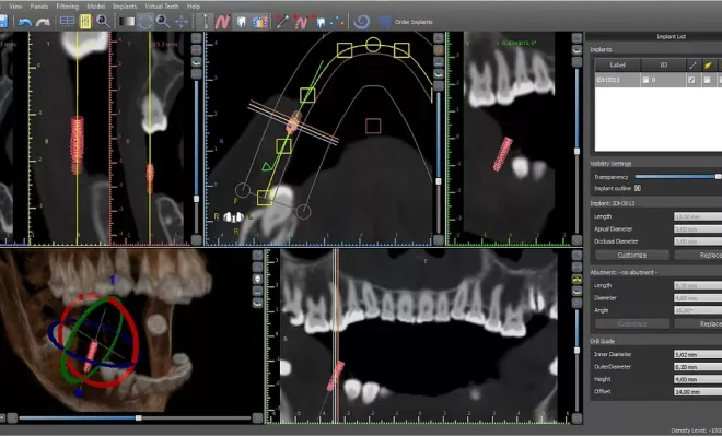 シミュレーションの様子