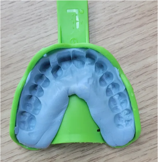 歯型取得キットについて｜Teeth Clean｜エチケットマウスピース