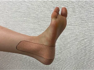 外くるぶしの上に持ち上げて貼る