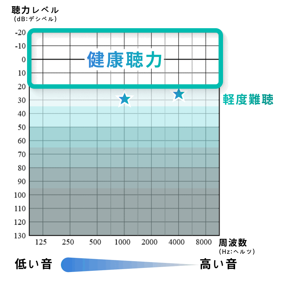 聴力検査の重要性