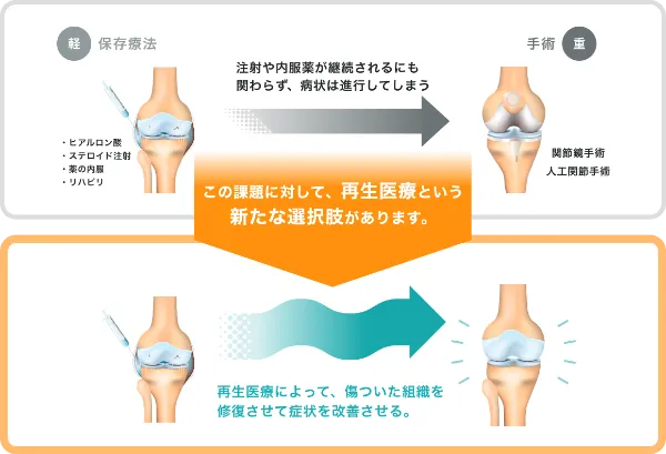 従来の保存療法と再生医療との症状の進行比較図