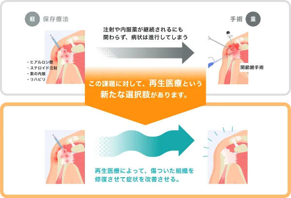 従来の保存療法と再生医療との症状の進行比較図