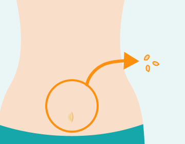 お腹から米粒数粒の脂肪を取り出すイラスト