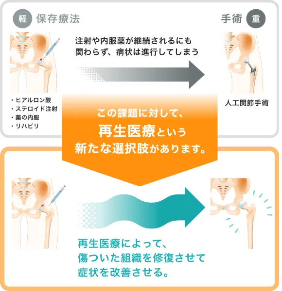 従来の保存療法と再生医療との症状の進行比較図